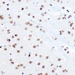 SETD5 Antibody in Immunohistochemistry (Paraffin) (IHC (P))