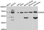 ZNF20 Antibody in Western Blot (WB)