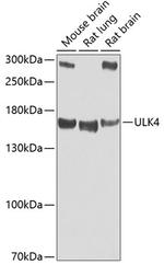 ULK4 Polyclonal Antibody