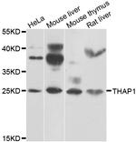 THAP1 Antibody in Western Blot (WB)