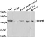 GSDMB Polyclonal Antibody