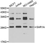 SAR1A Polyclonal Antibody