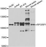 RPGRIP1 Polyclonal Antibody