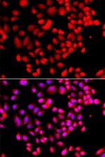 RPS6KL1 Antibody in Immunocytochemistry (ICC/IF)