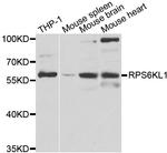 RPS6KL1 Antibody in Western Blot (WB)