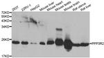 PPP3R2 Polyclonal Antibody