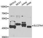 SLC27A4 Polyclonal Antibody