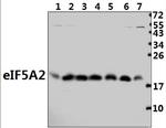 eIF5A2 Polyclonal Antibody