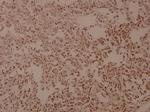 COL5A3 Antibody in Immunohistochemistry (Paraffin) (IHC (P))