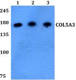 COL5A3 Antibody in Western Blot (WB)