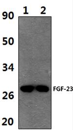 FGF23 Polyclonal Antibody