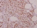 GSPT1 Polyclonal Antibody
