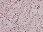 MINPP1 Polyclonal Antibody