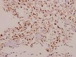 NDUFS5 Polyclonal Antibody