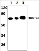 RhoBTB3 Polyclonal Antibody