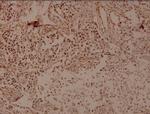 THOC5 Polyclonal Antibody