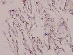 MATK Polyclonal Antibody