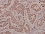 DRAK2 Polyclonal Antibody
