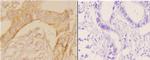 POTEKP Polyclonal Antibody