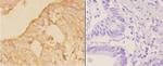 POTEKP Antibody in Immunohistochemistry (Paraffin) (IHC (P))