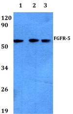 FGFR5 Polyclonal Antibody