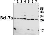 BCL7A Polyclonal Antibody
