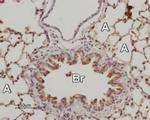 ADORA2B (extracellular) Antibody in Immunohistochemistry (Paraffin) (IHC (P))