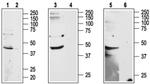 ADORA2B (extracellular) Antibody in Western Blot (WB)
