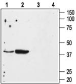 AGTR1 (extracellular) Antibody in Western Blot (WB)