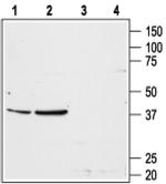 AGTR1 (extracellular) Antibody in Western Blot (WB)