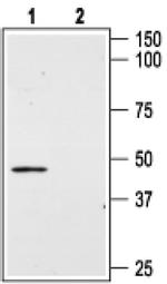 AGTR2 (extracellular) Antibody in Western Blot (WB)