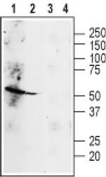 beta-2 Adrenergic Receptor (extracellular) Antibody in Western Blot (WB)