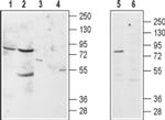 alpha-1b Adrenergic Receptor (extracellular) Antibody in Western Blot (WB)