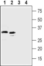 GPR77 (extracellular) Antibody in Western Blot (WB)