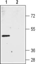 Bestrophin 2 (extracellular) Antibody in Western Blot (WB)