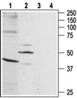 B1 Bradykinin Receptor Antibody in Western Blot (WB)