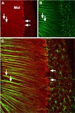 CaV2.1 Antibody in Immunohistochemistry (IHC)