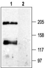 CaVpan alpha1 Antibody in Western Blot (WB)