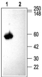 CACNB3 Antibody in Western Blot (WB)