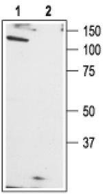 TRPC1 Antibody in Western Blot (WB)