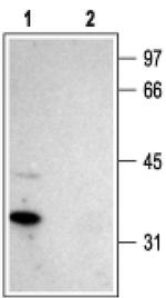 Stargazin Antibody in Western Blot (WB)