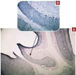 TRPC3 Antibody in Immunohistochemistry (IHC)