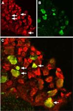 TRPV1 Antibody in Immunohistochemistry (IHC)