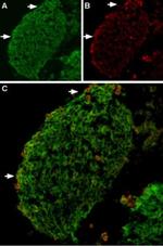 TRPV2 Antibody in Immunohistochemistry (IHC)