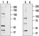 TRPV2 Antibody in Western Blot (WB)