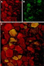 TRPV4 Antibody in Immunohistochemistry (Frozen) (IHC (F))