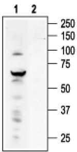 TRPV4 Antibody in Western Blot (WB)