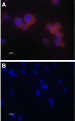 TRPV5 Antibody in Immunocytochemistry (ICC/IF)