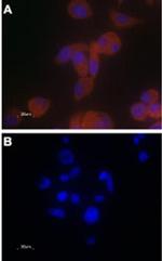 TRPV6 Antibody in Immunocytochemistry (ICC/IF)