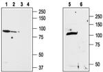 TRPV2 (extracellular) Antibody in Western Blot (WB)